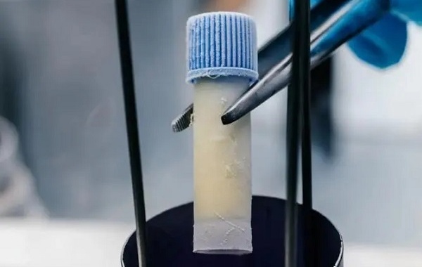女性有巴氏腺囊肿可以做二代试管移植冻胚吗？