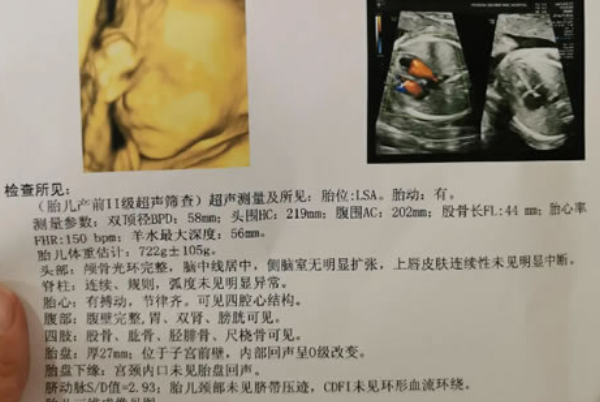 千万不要去私立医院做四维彩超原因盘点，选择公立更靠谱