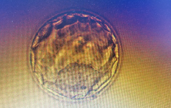 28岁三代试管卵裂期胚胎和4bc囊胚移植怎么选择成功率高？