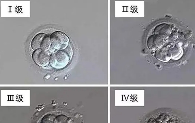 试管期间是不是所有的二级胚胎没有一级生出来的宝宝聪明呢？