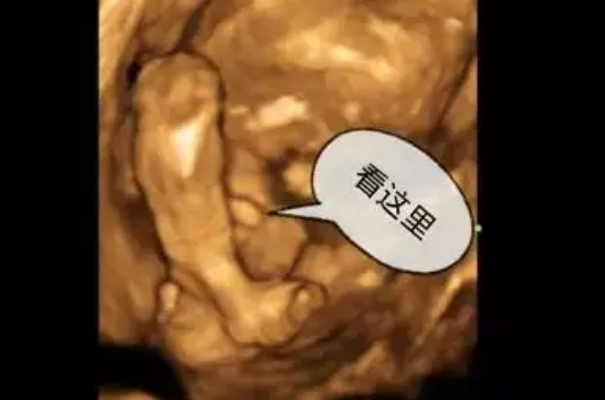 胎儿的姿势会遮挡生殖器官