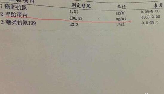 揭晓为什么检查甲胎蛋白，了解其临床意义你就知道了