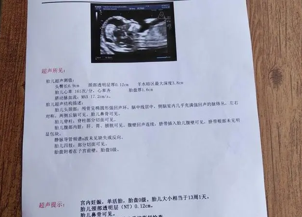正常nt值不超过3mm