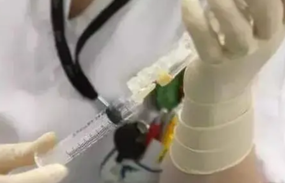 移植后注射白特喜能提高移植率