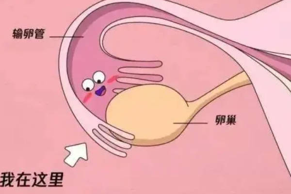 输卵管通而不畅
