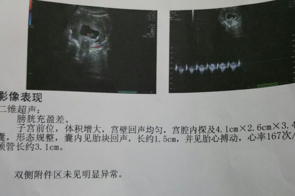 怀孕初期孕囊形态欠规则一般几天可以自动长好呀？