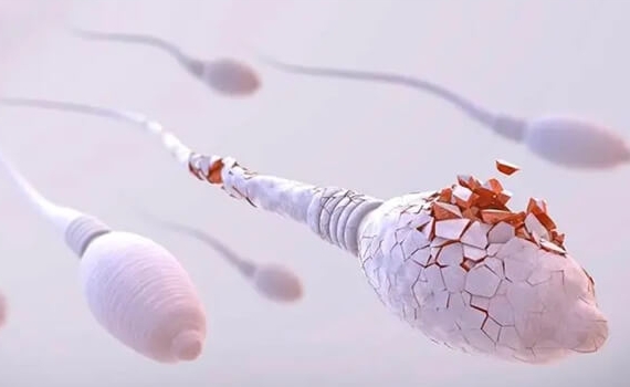 精子碎片