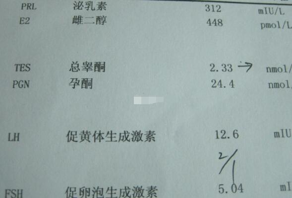 男性性激素六项检查指南，这些疾病一览无余！