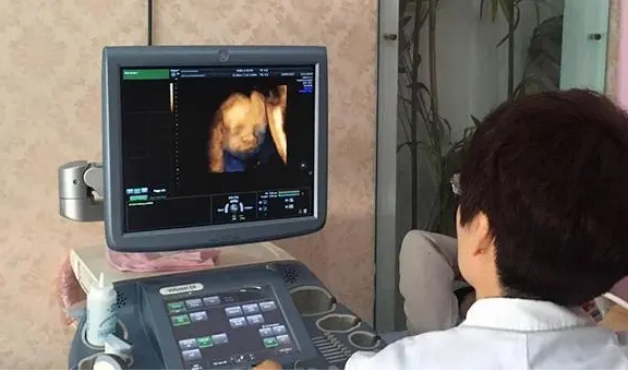 孕30周检查主要看胎儿是否畸形
