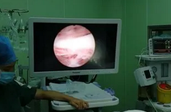 有没有备孕女性分享一下做宫腔镜检查的真实感受？