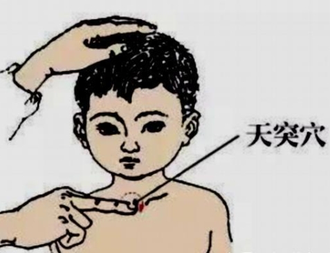 天突穴位于颈前部正中线