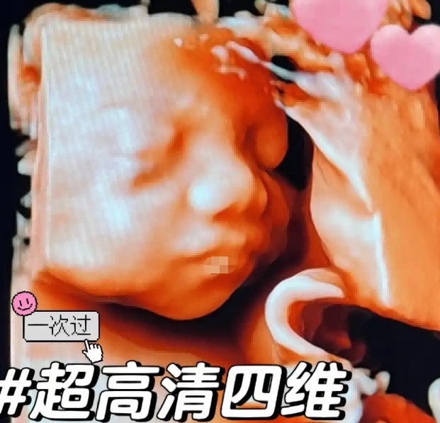 四维面相看男孩女孩的四个诀窍，男孩的鼻子可能相对较高